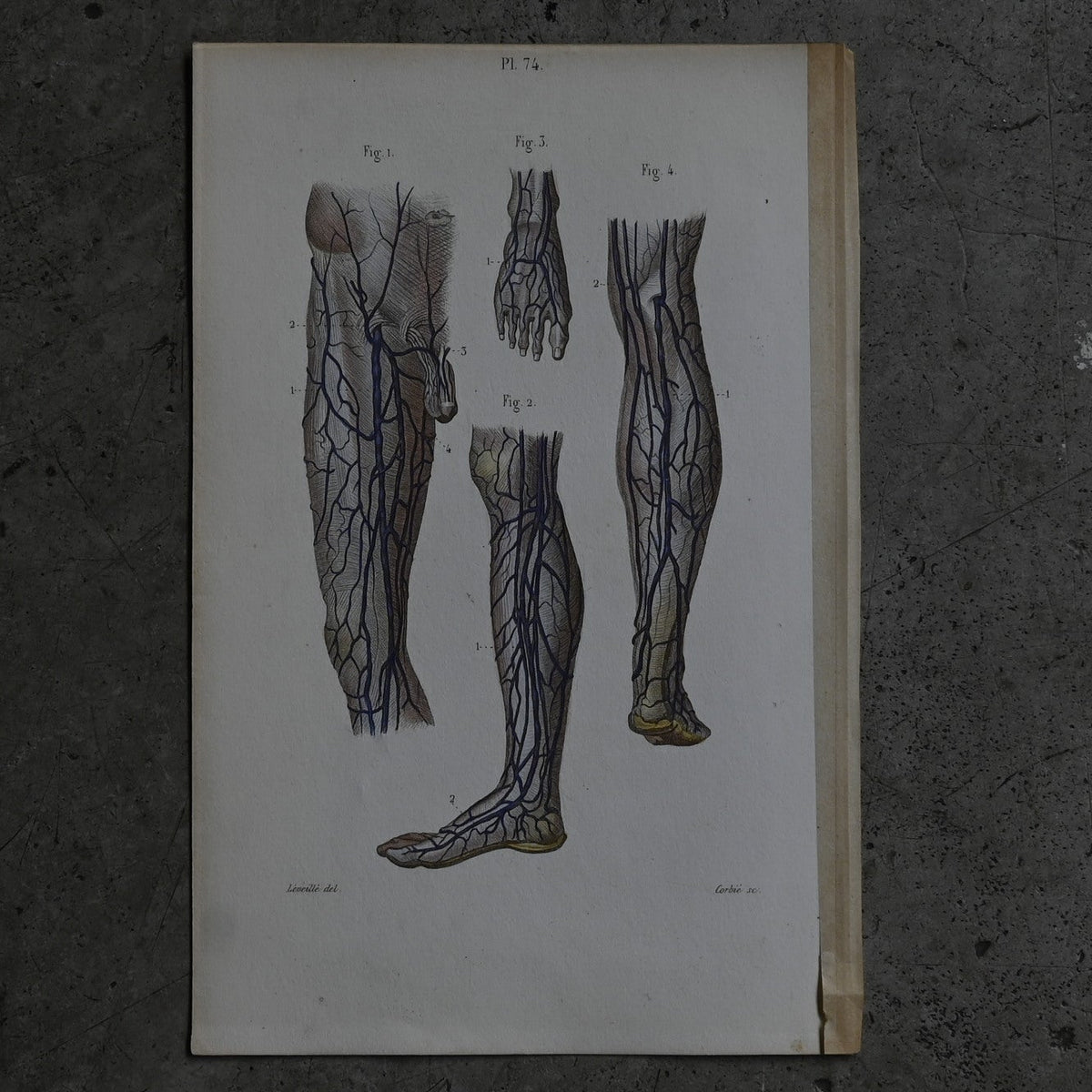 Anatomical Print – Veins of the Lower Limbs  PI.74｛RB-01120｝