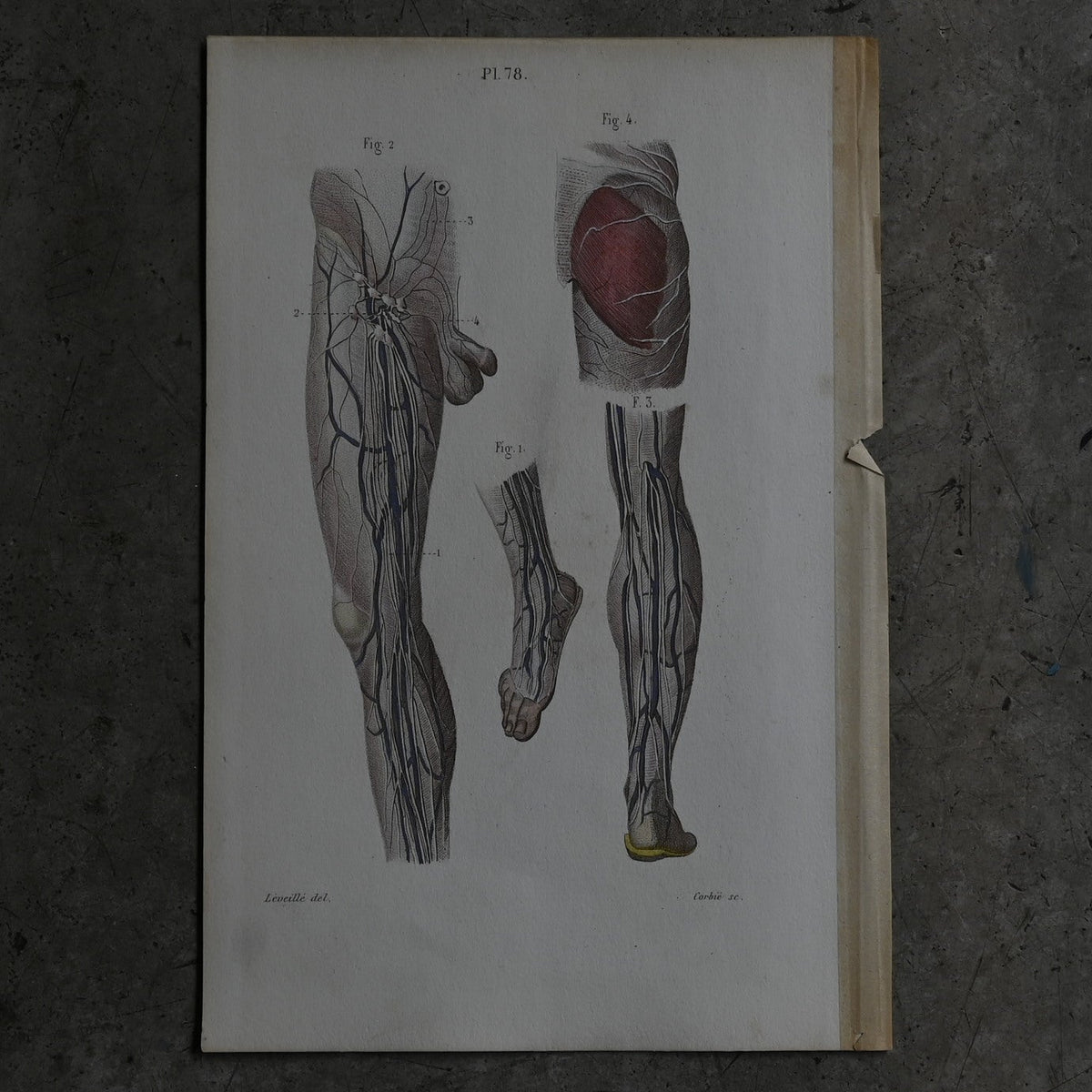 Anatomical Print – eins of the Lower Limbs  PI.78｛RB-01121｝