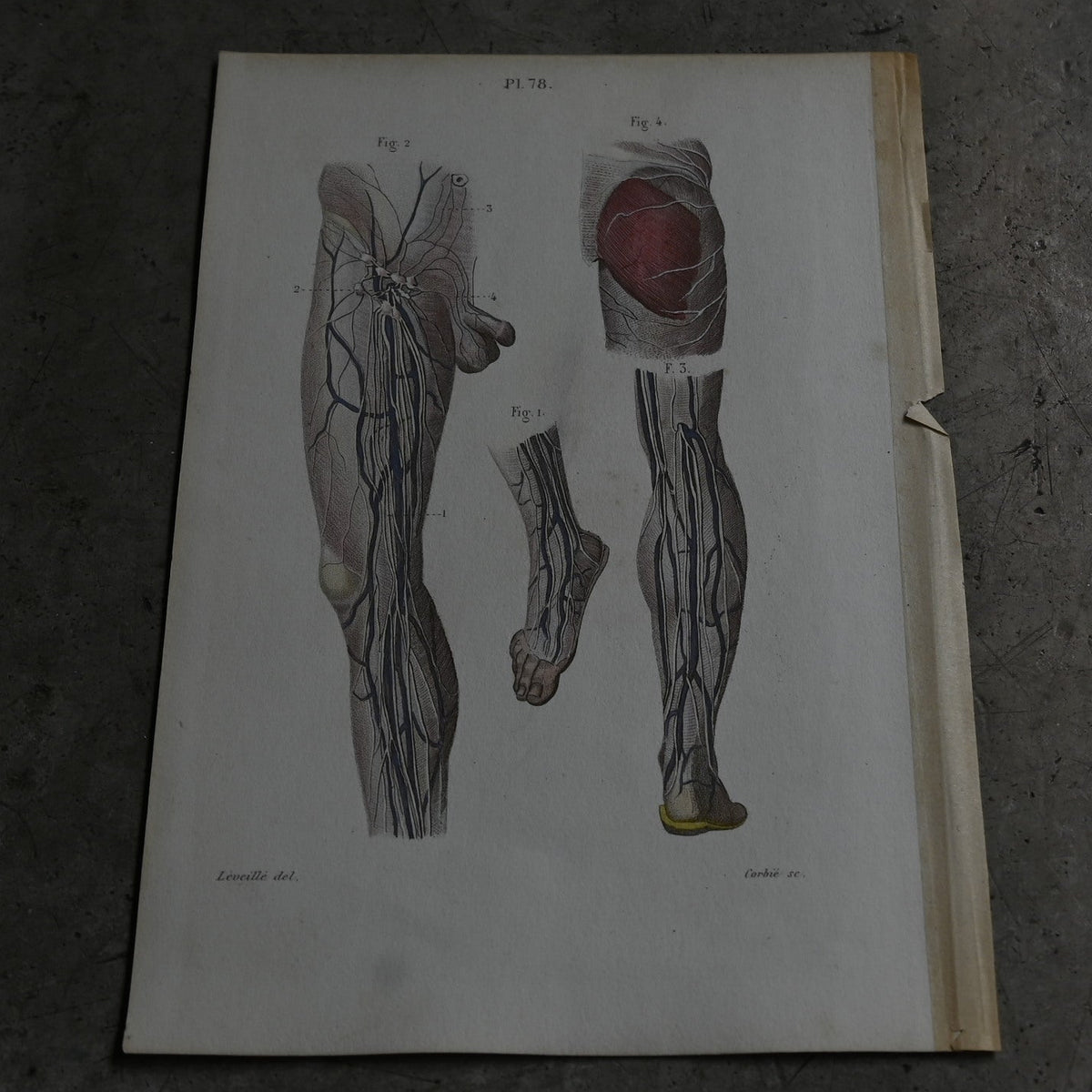 Anatomical Print – eins of the Lower Limbs  PI.78｛RB-01121｝