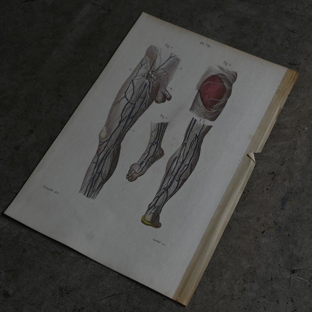 Anatomical Print – eins of the Lower Limbs  PI.78｛RB-01121｝