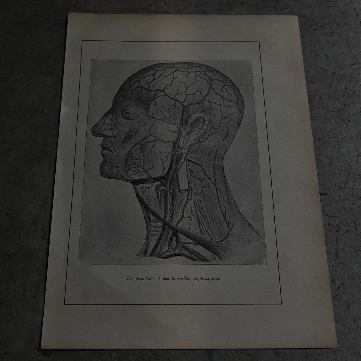 Medical Anatomy Print Ⅰ｛RB-01117｝