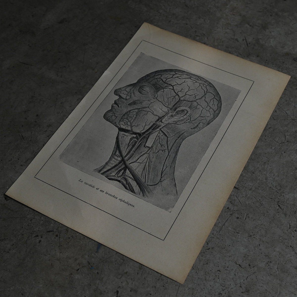 Medical Anatomy Print Ⅰ｛RB-01117｝