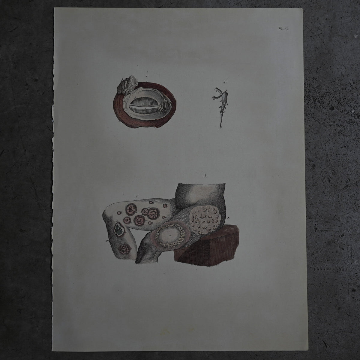 Anatomical Print  PI.52｛RB-01133｝
