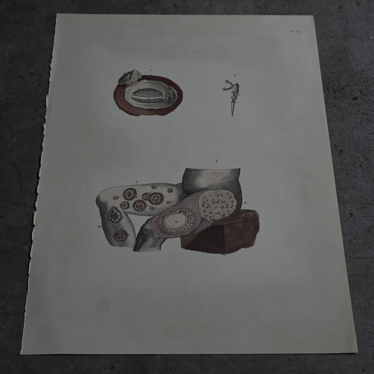 Anatomical Print  PI.52｛RB-01133｝