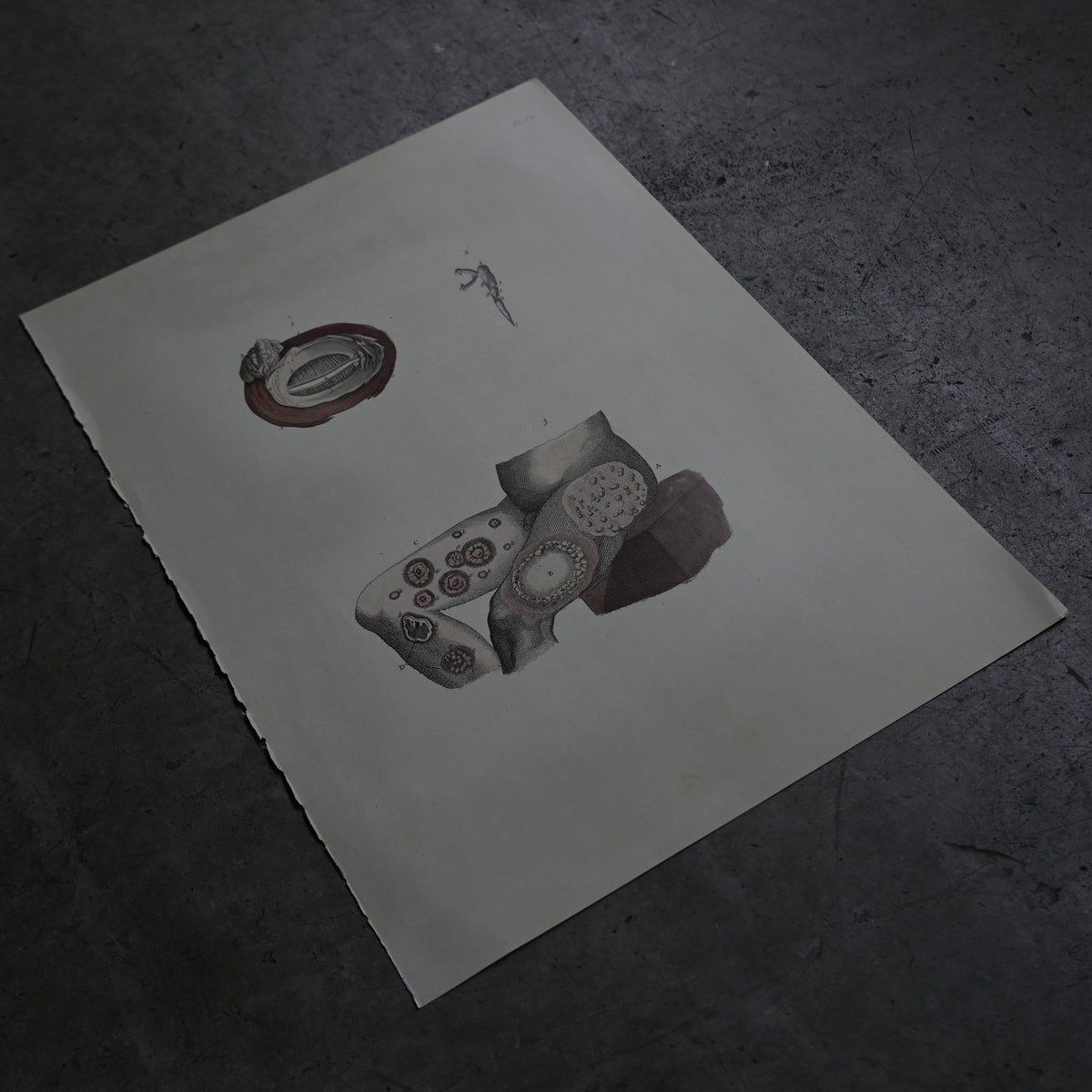 Anatomical Print  PI.52｛RB-01133｝
