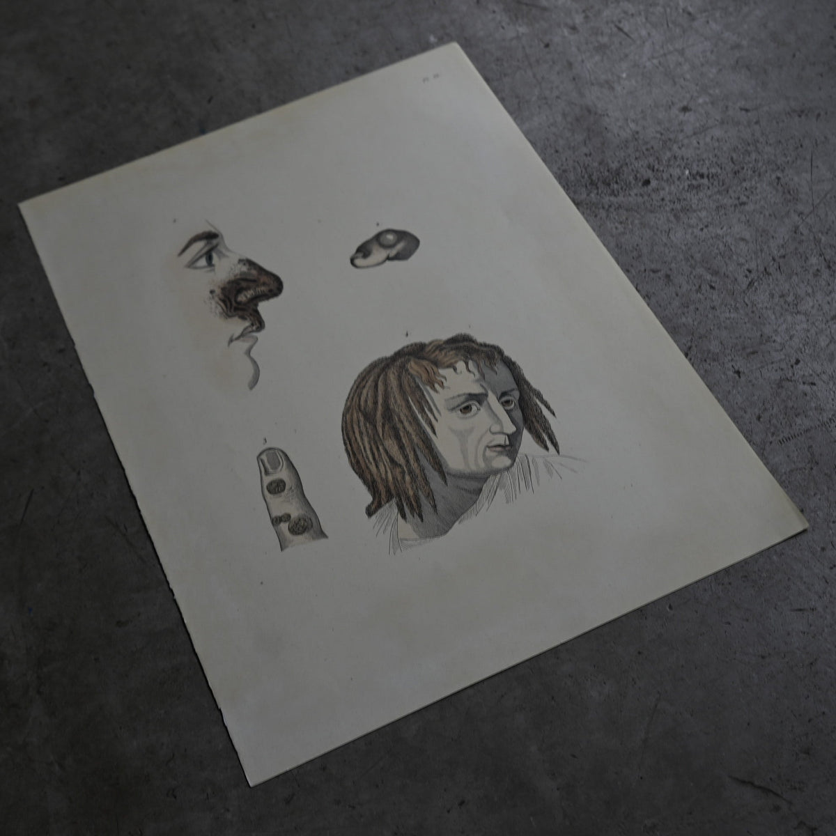 Anatomical Print  PI.56｛RB-01134｝