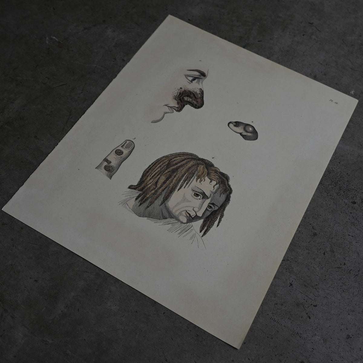 Anatomical Print  PI.56｛RB-01134｝