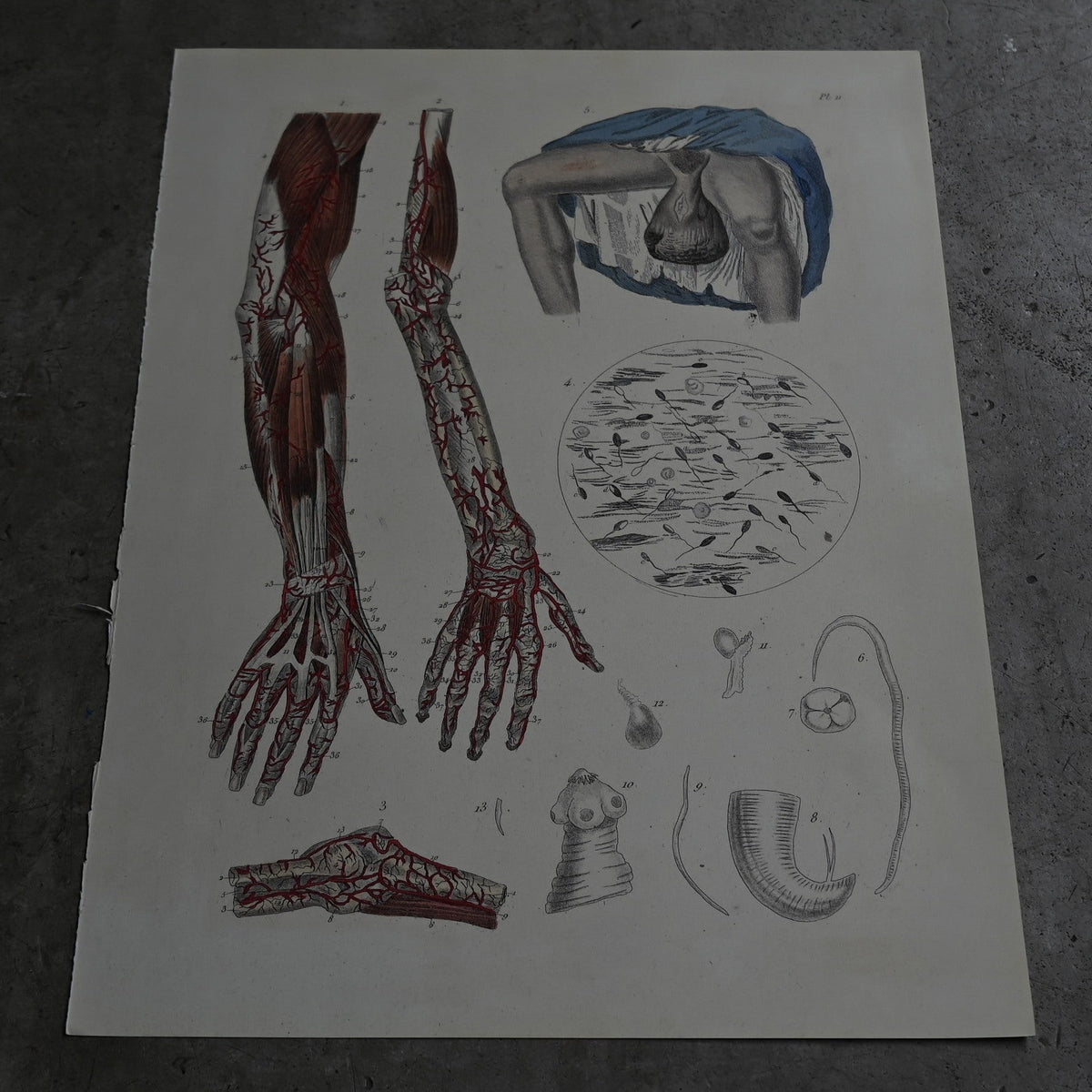 Anatomical Print  PI.11｛RB-01126｝