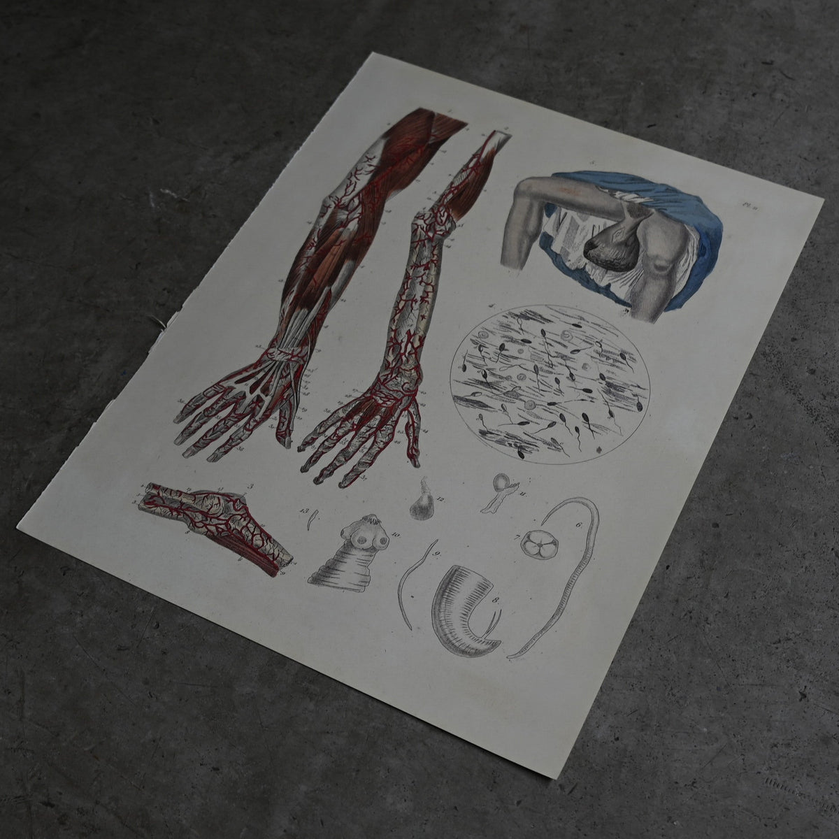 Anatomical Print  PI.11｛RB-01126｝