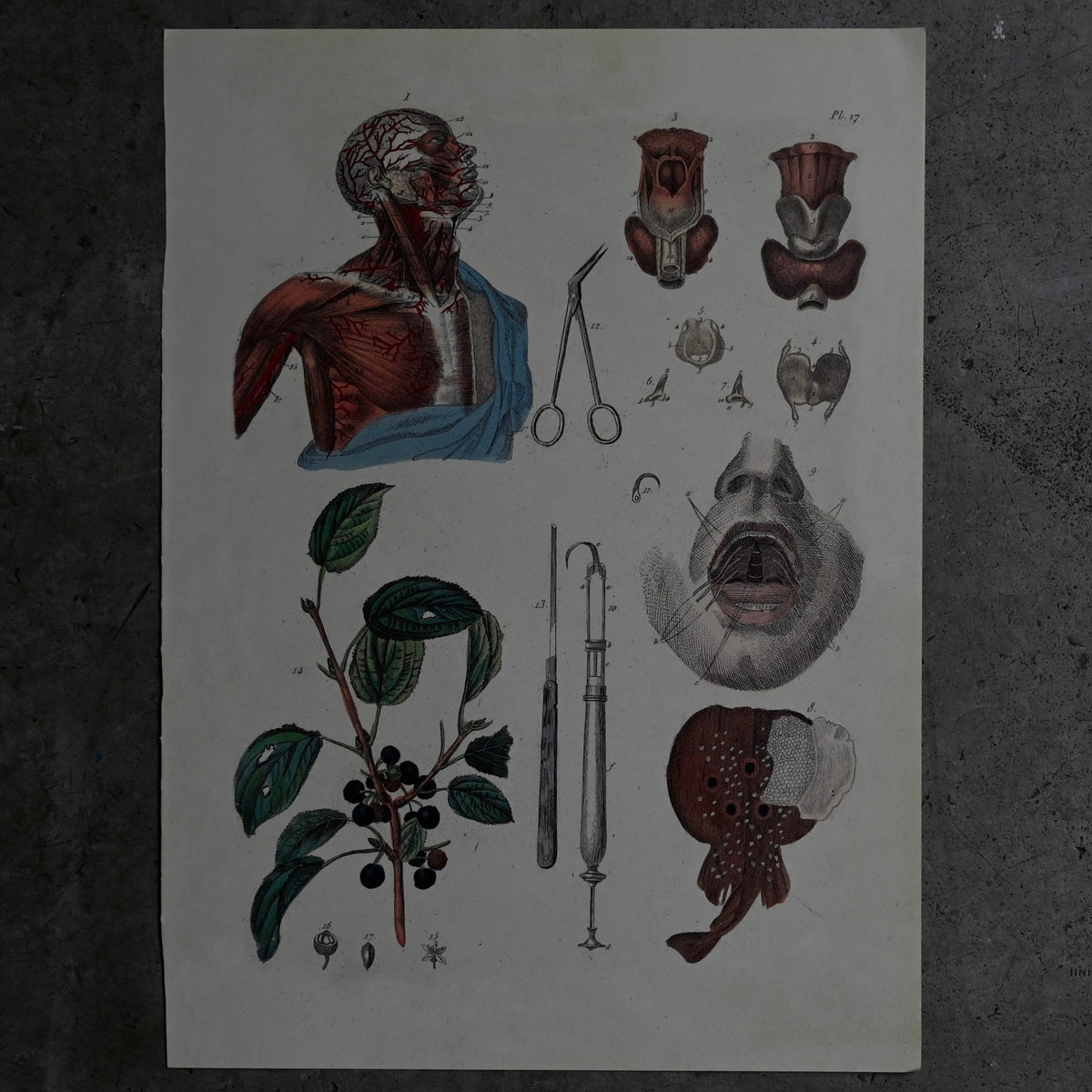 Anatomical Print  PI.17｛RB-01128｝