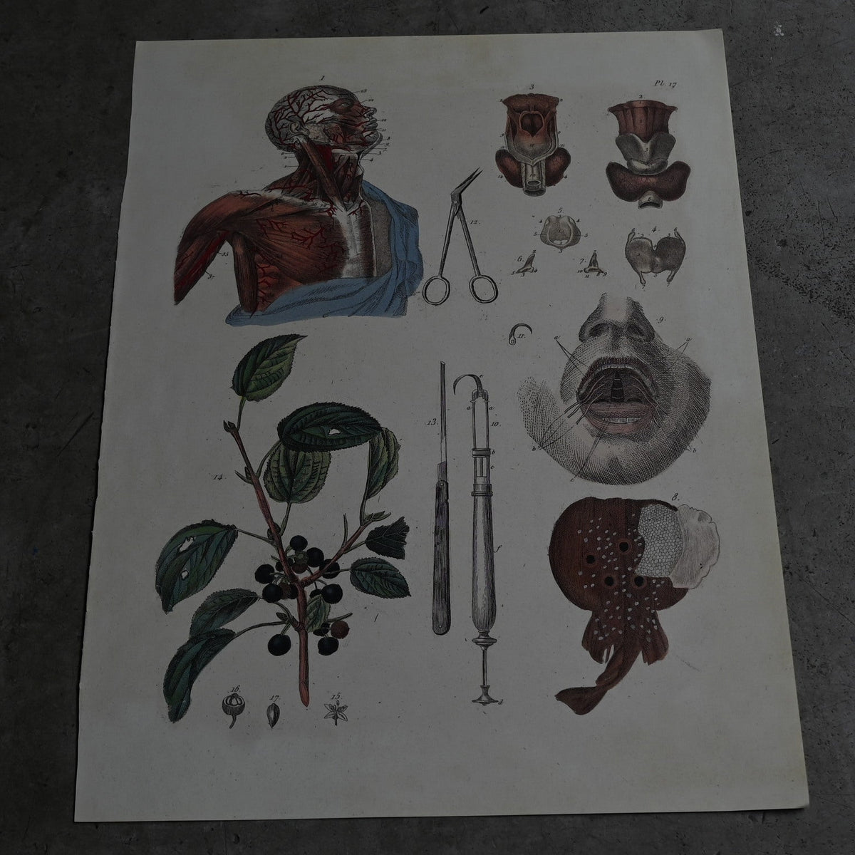Anatomical Print  PI.17｛RB-01128｝