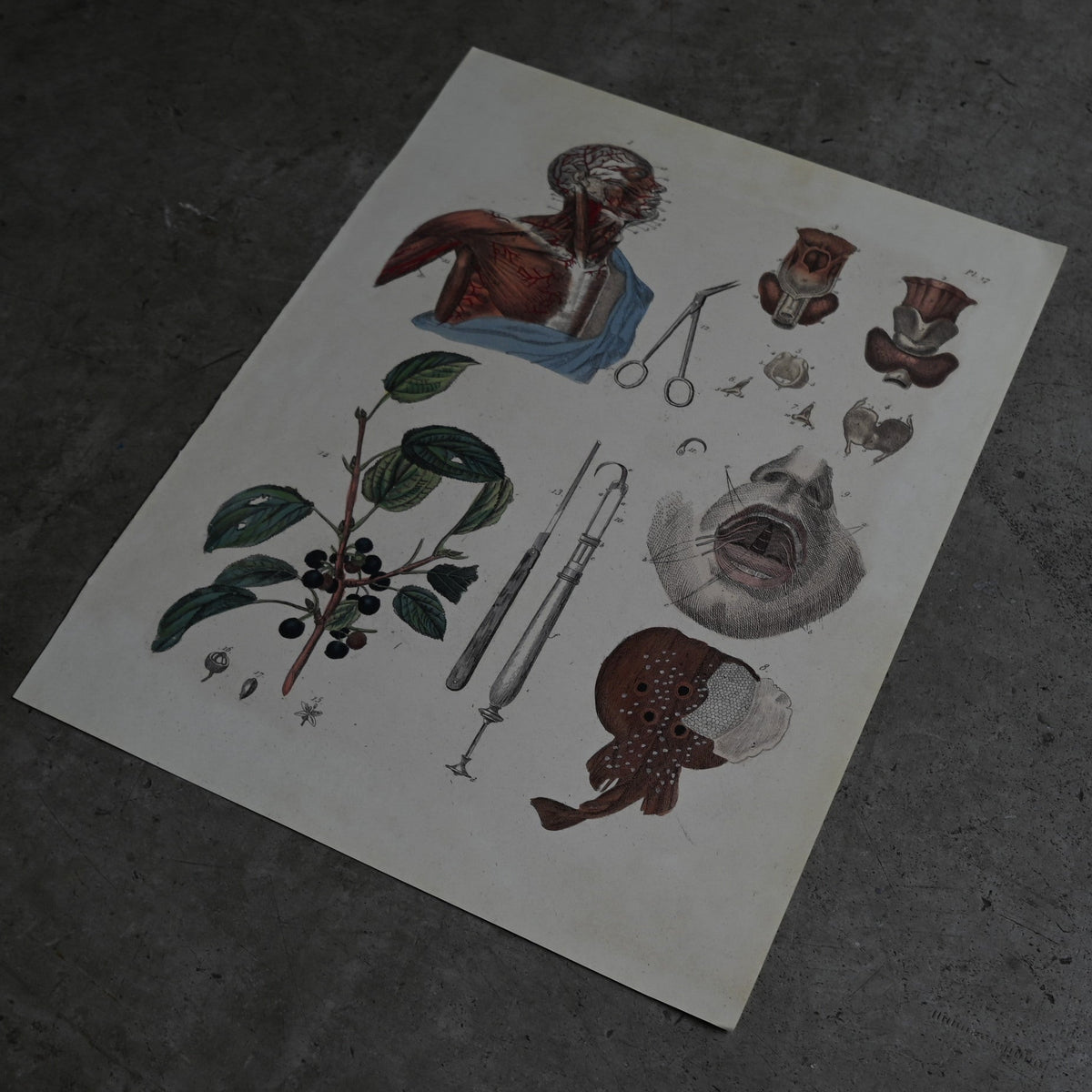 Anatomical Print  PI.17｛RB-01128｝
