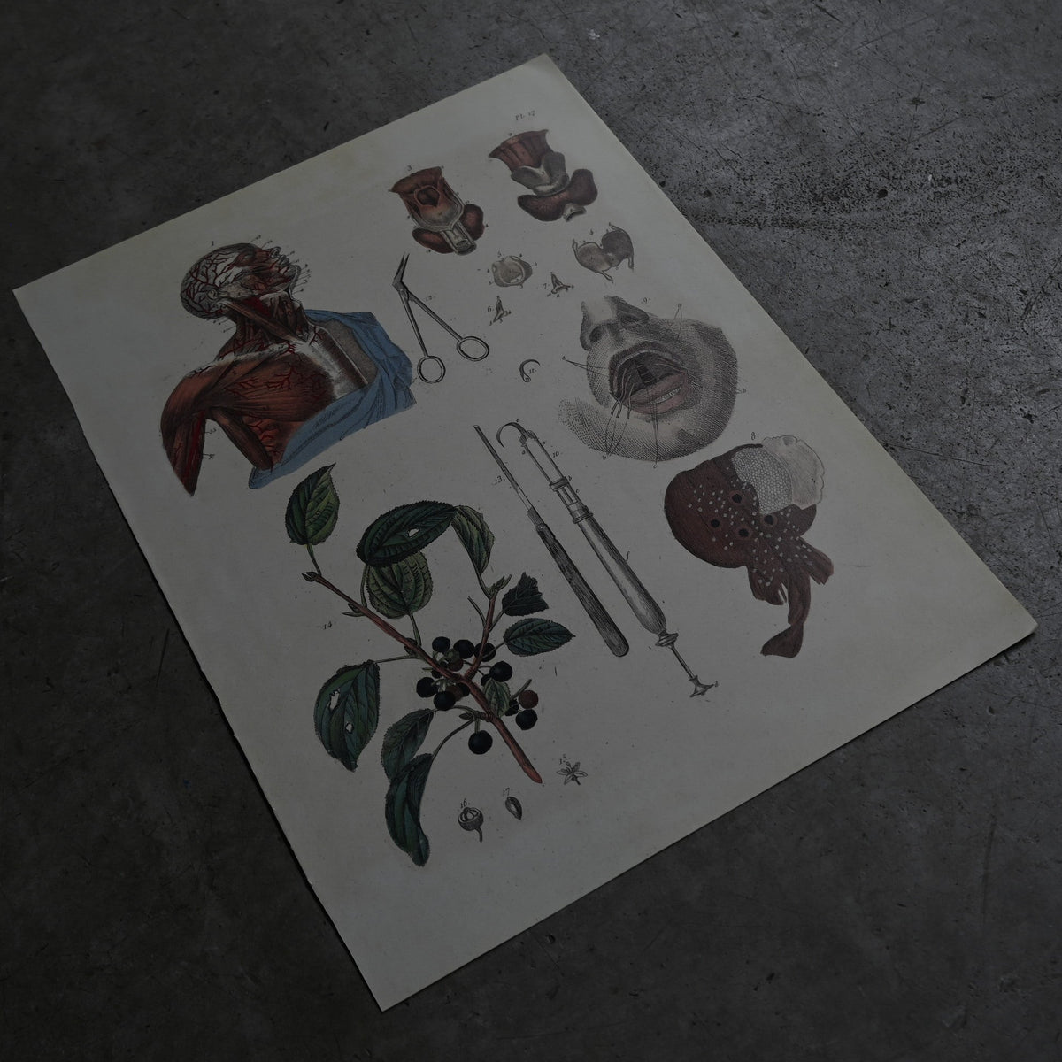 Anatomical Print  PI.17｛RB-01128｝